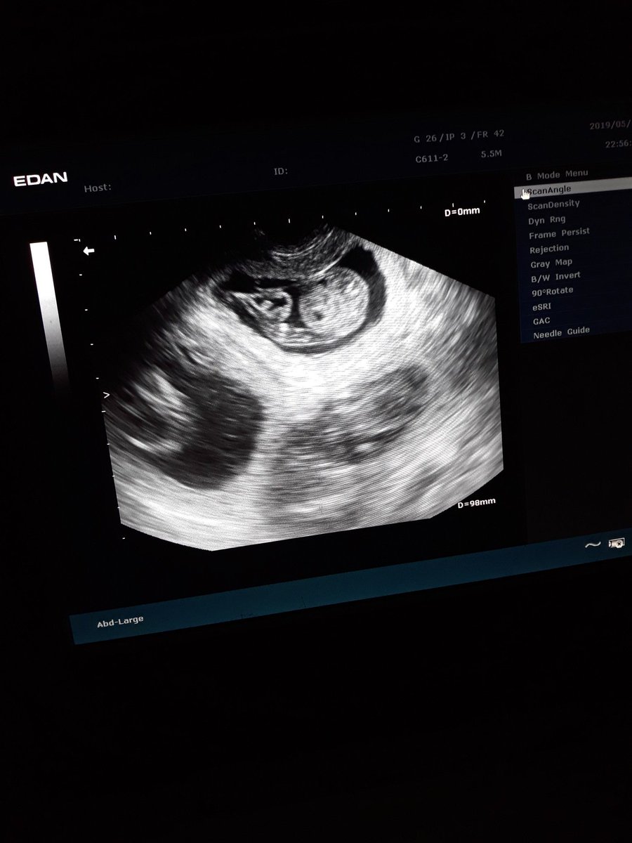 We're  back with some great news. Willow is expecting puppies sometime next week. A massive thank you to <a href="/WhiteCrossVets/">White Cross Vets</a> #Northampton for the scan, support and advice. I will keep you updated and promise lots of photos.