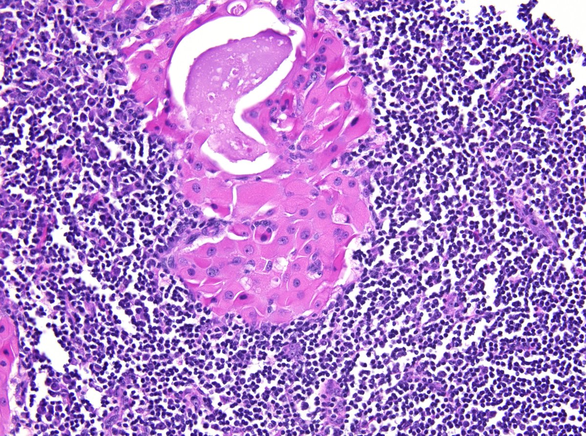 Syed Z. Ali tweet media