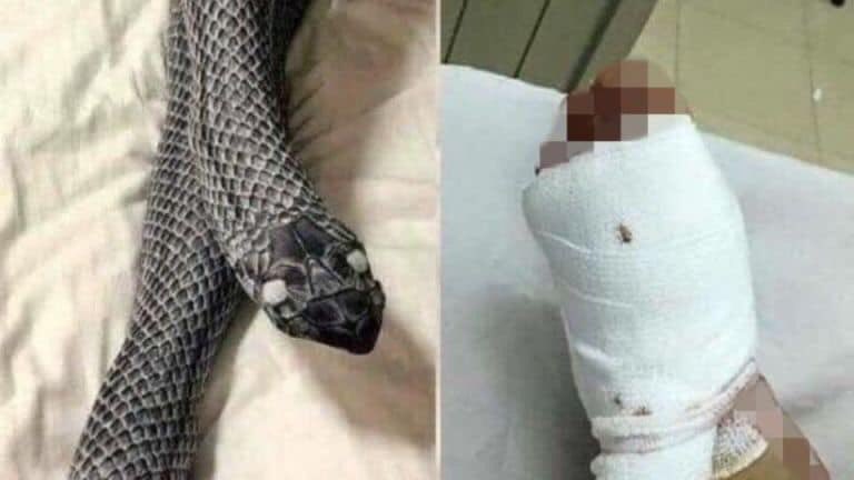 Tmakesmehappy's tweet photo. Una mujer resultó con lesiones muy graves luego de que su esposo le pegara con un fierro en su pie creyendo que era una serpiente. https://t.co/tZPdzT5eDJ