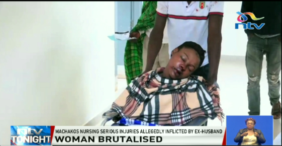 ntvkenya's tweet photo. A woman in Machakos county is nursing knife wounds inflicted on her, by her ex-husband. 

#NTVTonight @Sharon_Baranga https://t.co/4qz2PYeFOj