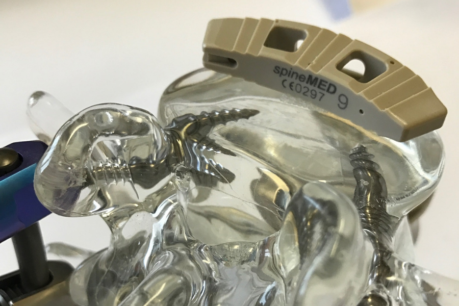 AcronMedical's tweet photo. Get maximum safety, maximum stability, and maximum efficiency with implants designed to address the needs of patients with osteoporosis in need of a spinal fusion. Contact us today to learn more. https://t.co/hS3axZWBv4 #medicaldevices #spinefusion #spinesurgery #medtwitter https://t.co/TkqYHXeS0Z