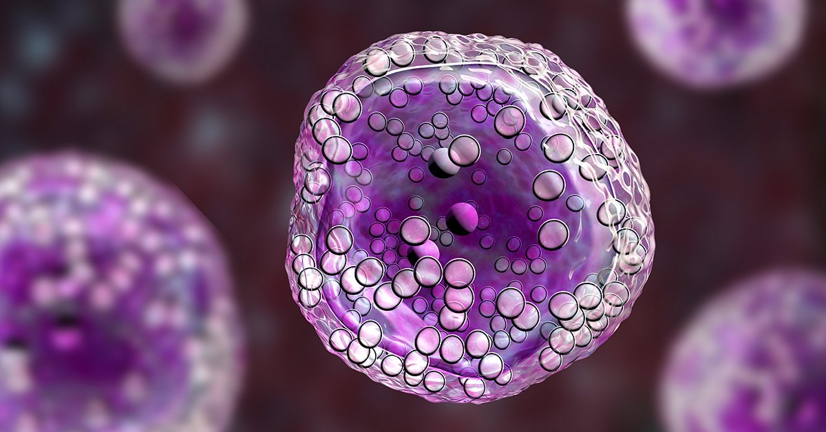 BloodCancerUtd's tweet photo. BREAKING NEWS: The @US_FDA approved the first chemoimmunotherapy regimen for patients with relapsed or refractory diffuse large B-cell #lymphoma, another important advancement for blood #cancer patients. Read more: https://t.co/18yZjw9kt2. https://t.co/SofSWztVGW