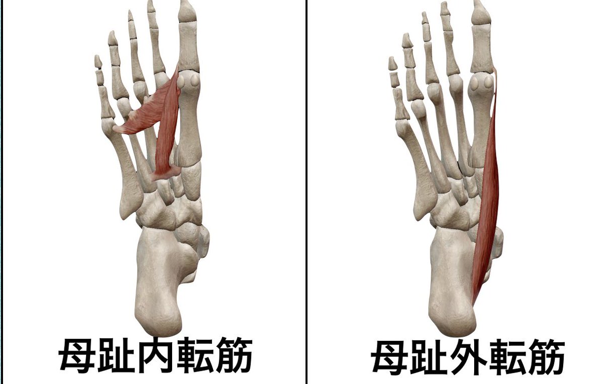 母趾外転筋