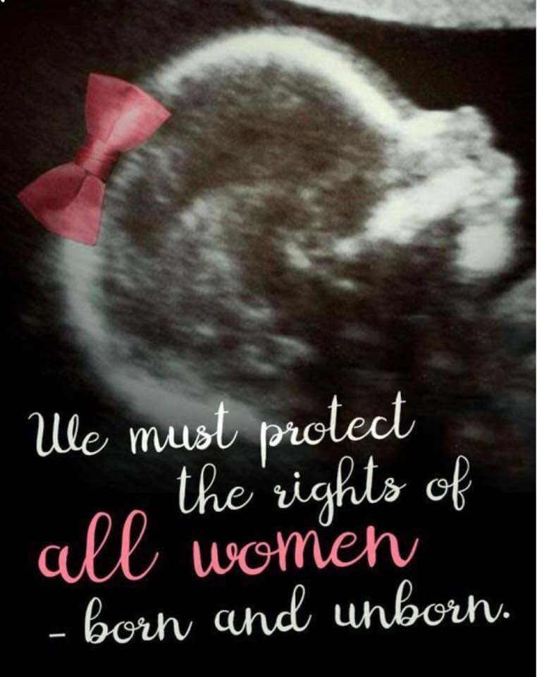 amidealist's tweet photo. 🎀Protect All Women

#CatholicTwitter
#ProLife
#EndAllAbortionNow
#RightsOfTheUnborn https://t.co/HjWZ8P6fic