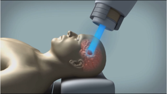 Interna81585298's tweet photo. https://t.co/y3TkblwXv3
Great article on #protonbeamtherapy.Key quote re: prostate PBT: why are private proton therapy providers still actively promoting their untested services to patients who already have a good chance of #survival? #cancerevents2019 https://t.co/eOdtWioqJp