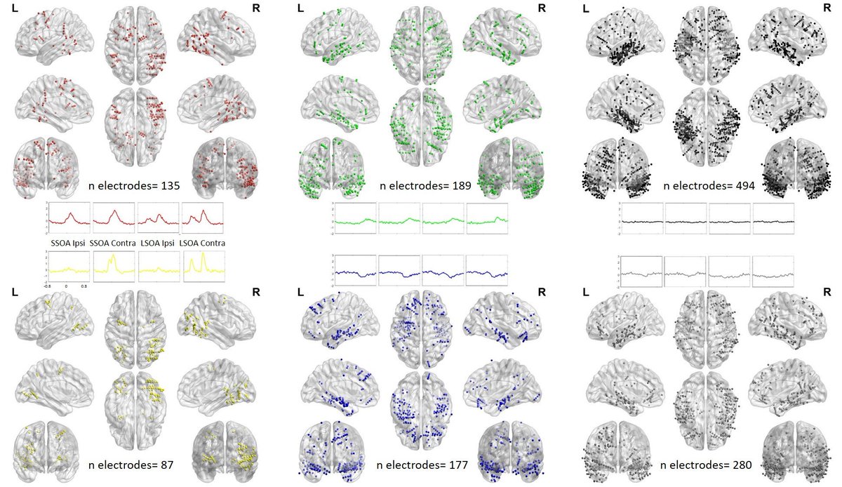 What can intracerebral recordings tell us about the neural basis of the inverse effect that changing the delay between cue and target has on RT? Come to my poster today at #OHBM2019 
T657 Spatiotemporal dynamics of exogenous attention: evidence from human intracerebral recordings