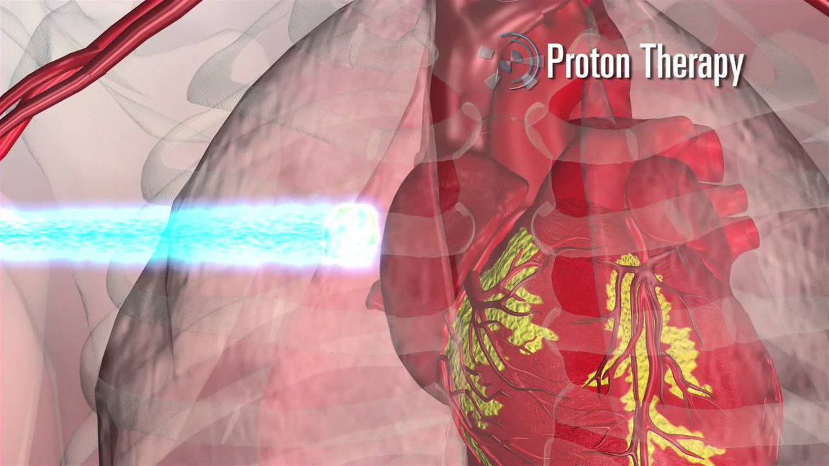 Interna81585298's tweet photo. https://t.co/y3TkblwXv3
When #cancer patients get #protontherapy instead of traditional photon radiation,they have less risk of related side-effects,with cure rates almost identical.Cutting edge machine learning shows best results,to know more attain the event @malaysia https://t.co/vj1lAM8rRa