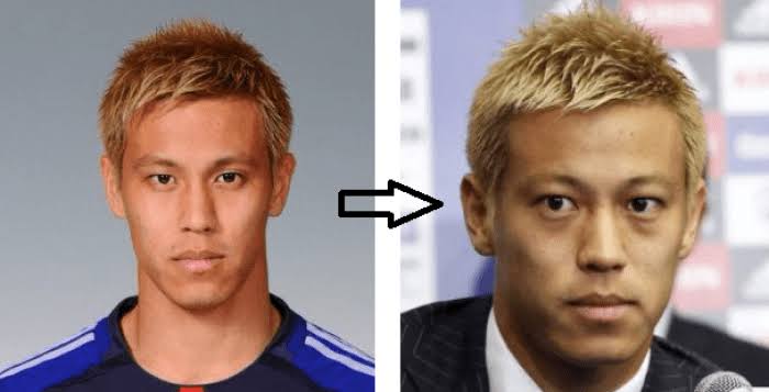 マルティァ 本田圭佑さん 医者の間ではまず間違いなくバセドウ病だと囁かれている 歳をとるにつれ眼瞼が膨らんで 目が出てくる 病気らしい 甲状腺機能亢進症なのでむしろ活発で だからこそ有名サッカー選手になれたのかもしれないね 画像は拾い物
