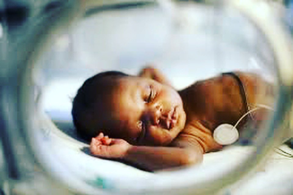 Genius_Baby_App's tweet photo. About 1 in 10 babies is born prematurely each year in the United States. 
#firsttimemom #pediatrician #babygenius #babyblogger #prematurebaby https://t.co/lbnrG0SJeb