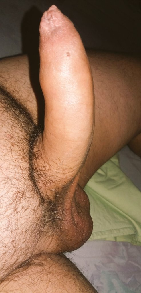 Its getting hoter in athens...