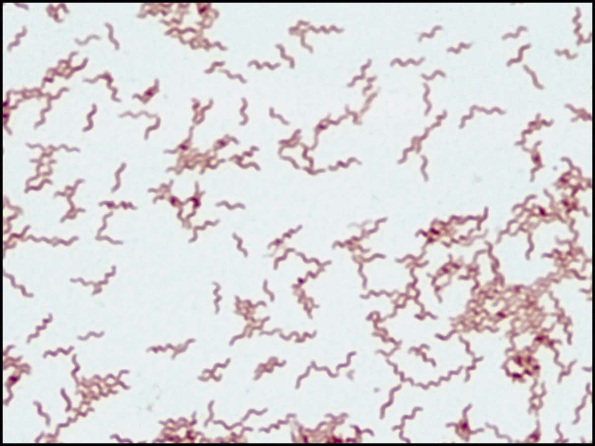 GregoryRMadden's tweet photo. A curious case of prosthetic joint infection in a dog breeder and heart transplant recipient due to Anaerobiospirillum, an unusual spiral-shaped bacterium found in the canine GI tract. https://t.co/A2rFjlNcjm @UVA_ID https://t.co/IgiHWR90jT