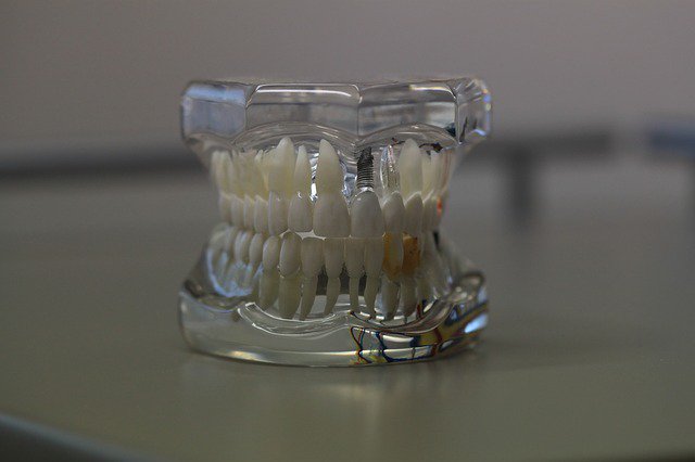 a1DayDentures's tweet photo. 3 Standards You Should Have for Your Dentures
https://t.co/d9Bp6D8X8Q

#implants #dentures #dentalhealth #michigan https://t.co/m6ocRpctTT