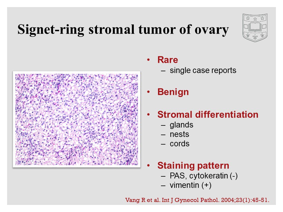 Signet ring carcinoma parotid gland: A case report - Singh - 2011 - Head &  Neck - Wiley Online Library