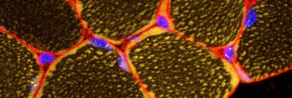 AFM-Téléthon PRESSE (@afmpresse) on Twitter photo Une équipe de Généthon, labo <a href="/Telethon_France/">AFM-Téléthon</a>, réalise la 1ère preuve de concept in vivo d’une approche #CRISPR -Cas9 dans la maladie de Steinert, + fréquente maladie neuromusculaire de l’adulte. Prochaine étape : traiter le corps dans son ensemble 👉 bit.ly/2J5CXjI Une équipe de Généthon, labo <a href="/Telethon_France/">AFM-Téléthon</a>, réalise la 1ère preuve de concept in vivo d’une approche #CRISPR -Cas9 dans la maladie de Steinert, + fréquente maladie neuromusculaire de l’adulte. Prochaine étape : traiter le corps dans son ensemble 👉 bit.ly/2J5CXjI