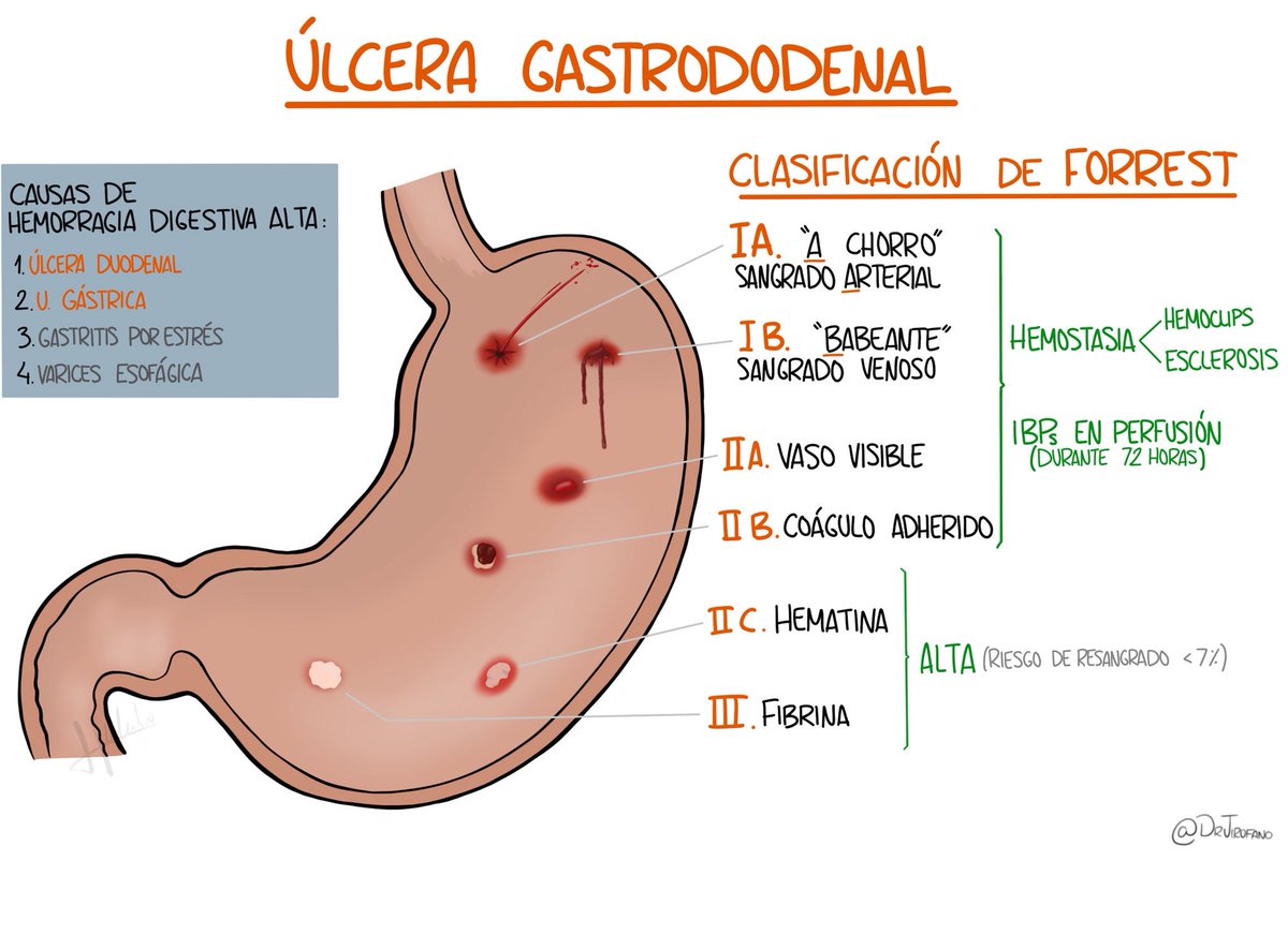 Se cura la gastritis atrófica