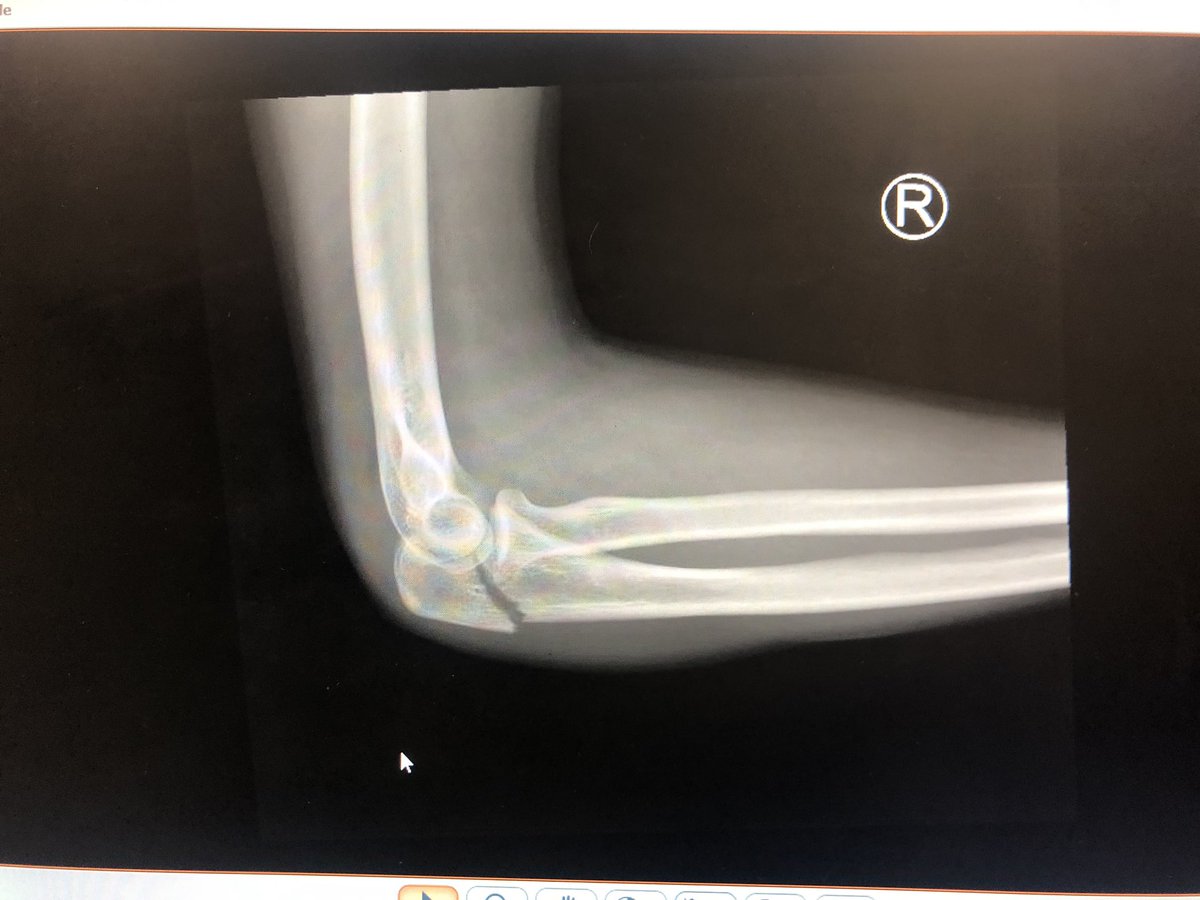 Lawrence Carpenter tweet media