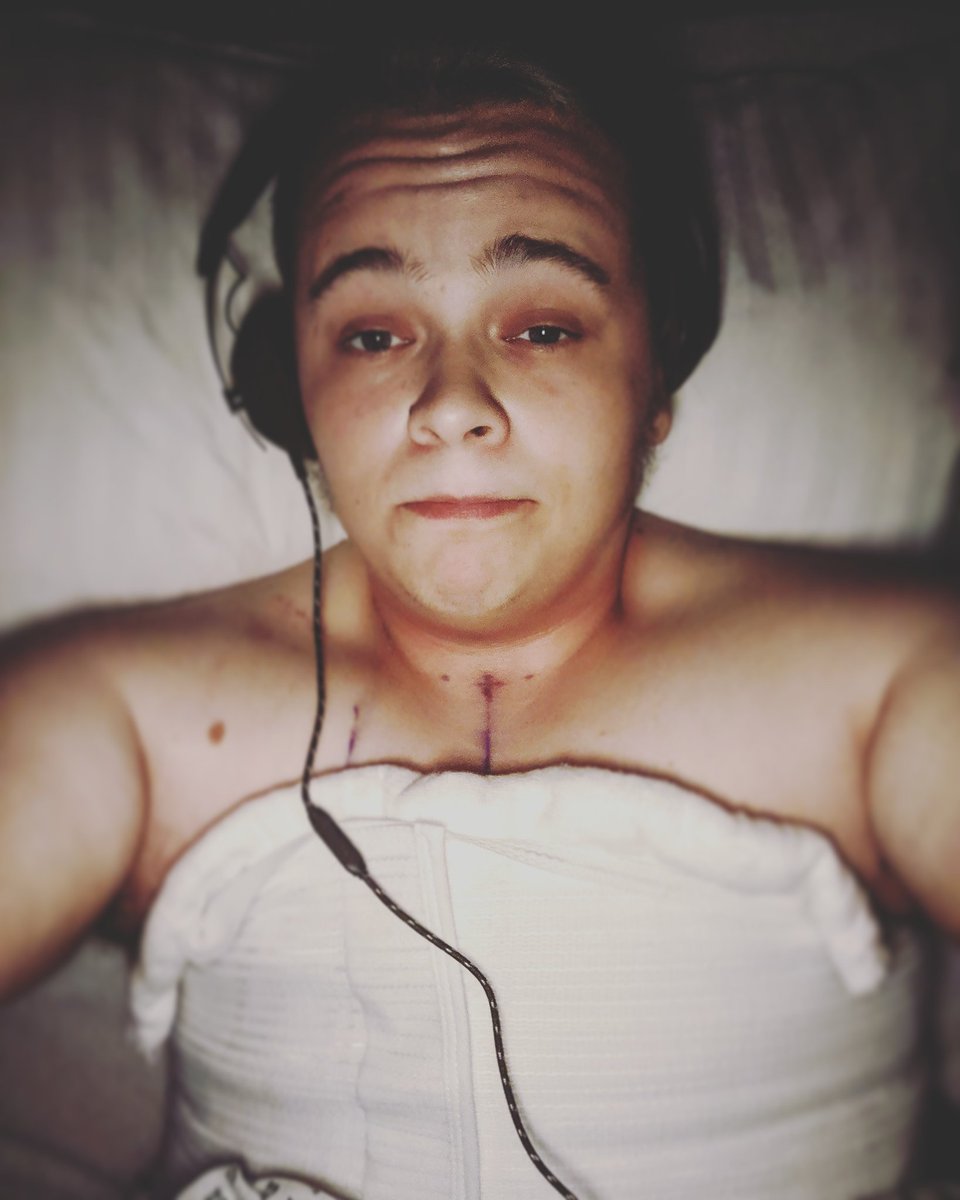 Wolf_Matty's tweet photo. Well my lovelies, the test yeet is complete ! 
After 8 long ass years I have finally had top surgery. Staying in hospital one more night due to a minor issue with my drains but otherwise I'm doing great and on the road to a speedy recovery 😊 https://t.co/W4E2r6QCjt