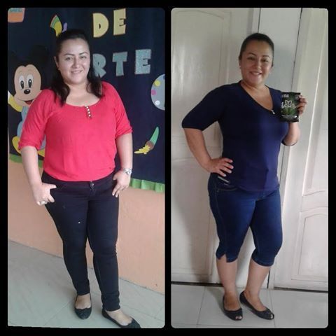 IasoteaGT's tweet photo. “Hola, yo perdi peso usando el Iaso Tea y las gotas Resolution me siento mucho mejor. Mi autoestima subió mucho ya que por mi sobrepeso no quería salir de mi cuarto. Ahora soy socia de TLC  y sigo bajando más de peso.  Total Life Changes me está cambiando la vida.” ~Denny Cedeño https://t.co/Ny3cILEkjW