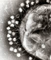 MicrobesInfect's tweet photo. Professors &amp; students in a research class have discovered #bacteriophages in their kitchen sponges.

The students isolated bacteria from their own used kitchen sponges &amp; used the bacteria as bait to find specific #phages.

https://t.co/u8yRcV5DBA #bacteriophage #ASMicrobe https://t.co/pRRljujkl9