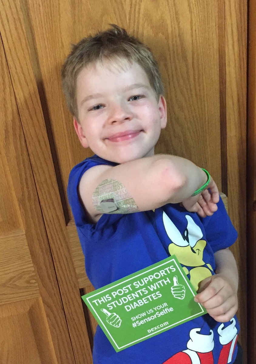 createdbybarbi's tweet photo. My little guy showing off his #Dexcom 😁💙 @dexcom is donating $1 to @CollegeDiabetes for every #sensorselfie - always a great cause to help find a cure #T1D #type1diabetes https://t.co/Z0spDd3NSn