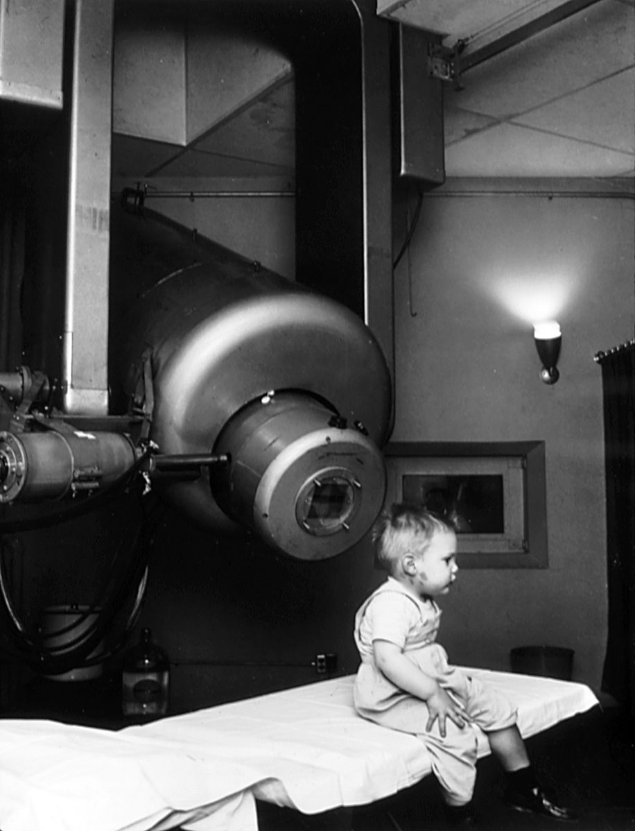 This is Gordon Isaacs. He was the first person treated with a Linear Accelerator. Gordon received electron beam #radiotherapy in 1957 to treat retinoblastoma in his left eye. Gordon's treatment was a success - he survived into adulthood with normal vision. #Radiotherapy4Life