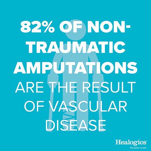 AdventistHC's tweet photo. 82% of non-traumatic amputations are the result of vascular disease. Take our heart health risk assessment to learn your risk for vascular disease and beyond. #Healogics #WoundCareAwarenessMonth #LoveYourHeart https://t.co/zZKYHOy2fC https://t.co/InAX7CzBDC