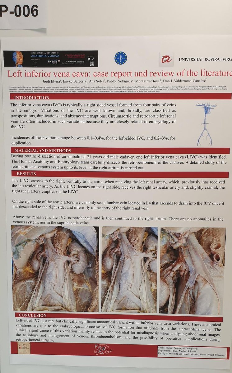 eneko70's tweet photo. Fran Valderrama presentando póster sobre caso de “Vena cava inferior izquierda” en #ISCAA International Congress of Clinical and Applied Anatomy!!!#JointmeetingofEACA. https://t.co/jXSfBm4BE5. Bravo 👏👏👏👏@FranJValde @URVmedicina @UrvAnatomia @Jordi_Elvira!!! https://t.co/Ml3POP8oCd