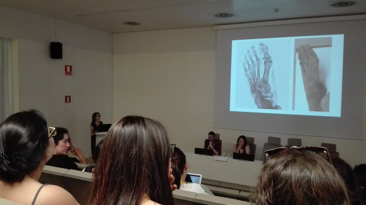 cmpereirasantos's tweet photo. Assumpci{ Malgosa @UABBarcelona presenta en el congreso de la #SEAF2019 el estudio multidisciplinar de un soldado de la guerra del Pacifico! https://t.co/yFylZXZPKI