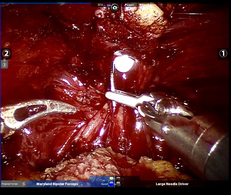 chiaridelprete's tweet photo. My @ERUSrobotics curriculum is going on!
Today my 1st #roccostitch with my Prof. @bernardorocco73 !!! 
Such an onor !!! 

@orsiacademy @alexmottrie @eau_yuo @Uroweb @socroboticsurg @UNIMORE_univ https://t.co/LLPZDyWmVo