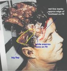 oneunderstands's tweet photo. @CraigRegan18 @chas_usa but hey who cares?
we know people don't conspire theories only murder
so lets sit jfk back up+ignore that the new digital footage
has had the bottom cut off it to hide the offending gun flash
recall he was leaning slightly forward

jackie retrived a part of his skull from the boo https://t.co/w4l4NgOygn