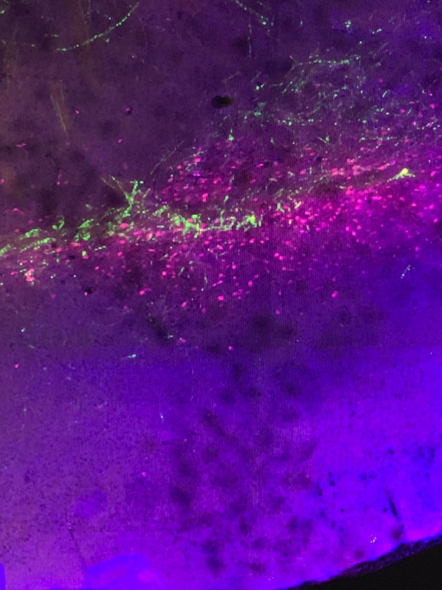 RIKEN_CBS's tweet photo. There is nothing more satisfying than seeing the results of your experiments under the microscope. Although our brains are not naturally multicolored artworks like this, images like this always make me more aware of the vast complexity of it all. -SA #NeurotechCBS https://t.co/FuuS6MBuKC