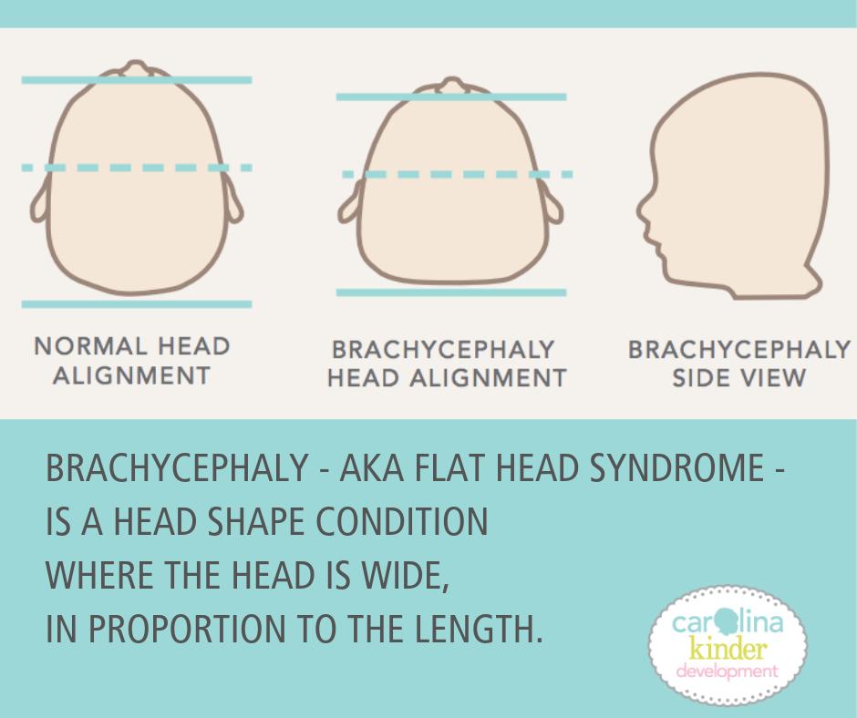 Carolina_Kinder's tweet image. #Brachycephaly is more complex than just back sleeping.  Other factors such as prematurity, low birth weight, torticollis, dislike/unfamiliarity with tummy time, and/or overuse of gear like swings and carseats can contribute to brachycephaly for some babies. #Headshape