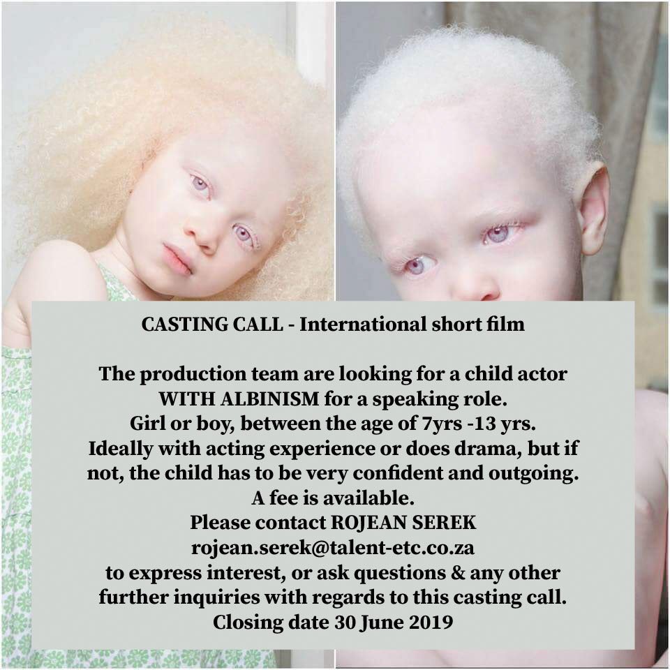 CASTING CALL for my next film in South Africa... #castingcall #Albinism