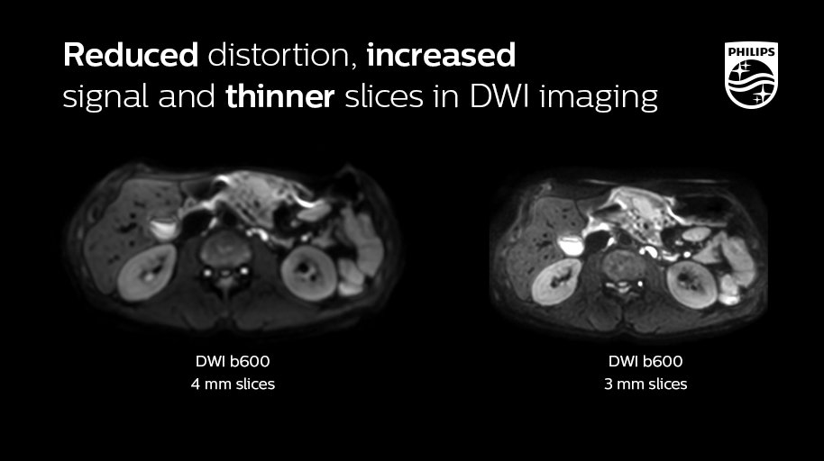 PhilipsHealth's tweet photo. Technical University Munich is using the benefits of the enhanced Vega HP gradients of Ingenia Elition to their advantage. Find out more and download related protocols via #MRBodymap https://t.co/BuQGp7iynv #TheNextMRWave https://t.co/KuCai2RYTe