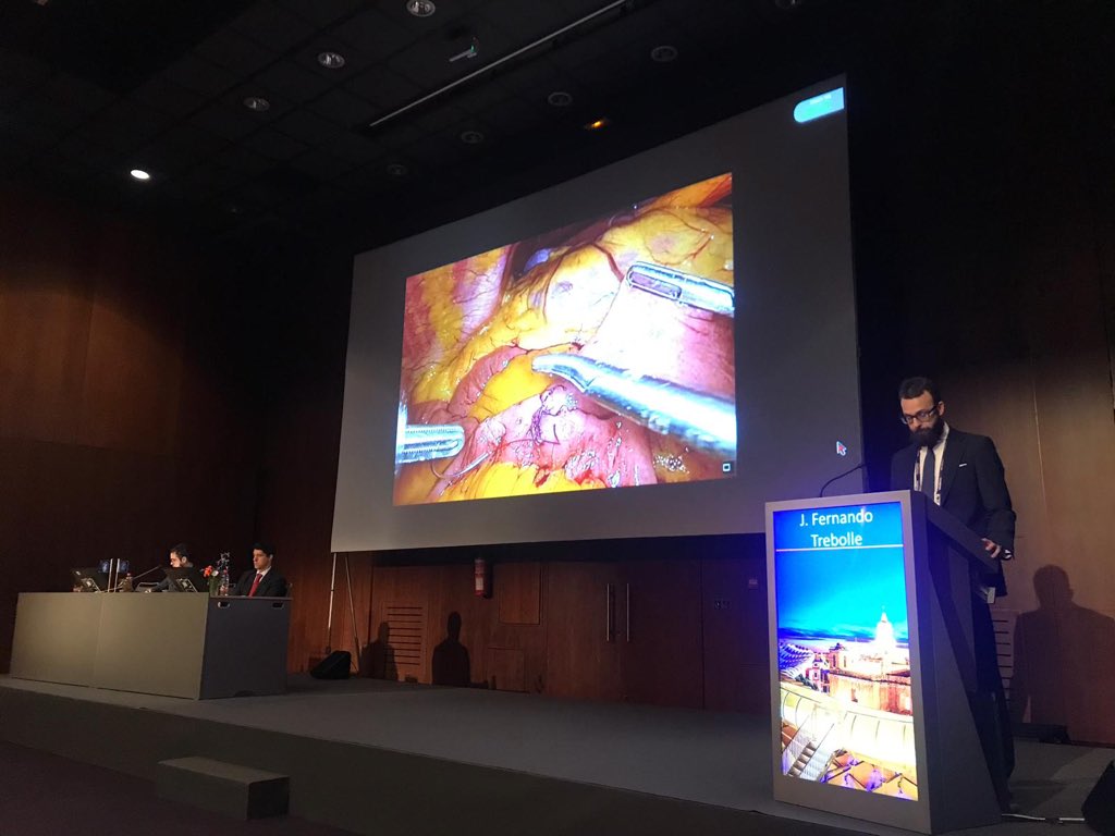 jftrebolle's tweet photo. #EAES2019 "Laparoscopic Roux-en-Y gastric bypass: two technical alternatives" (S52 Best videos bariatric surgery) @EAES_eu @JLBlasLaina @EgeaJorge @p_palazios  @sborlan1 @CrosBeatriz @unitomia #cirugiahrv https://t.co/J9F00jDUfH