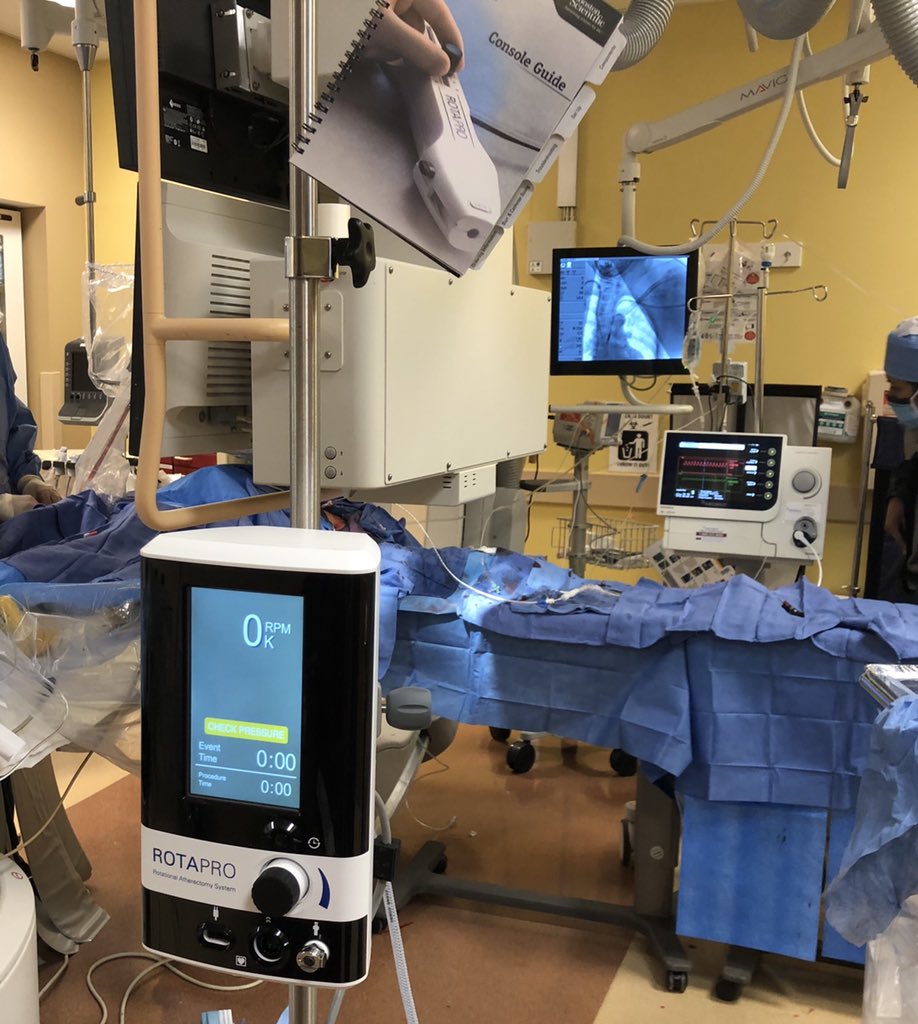 RajTayalMD's tweet image. After considering making an early transition to industry but struggling to walk away from the lab, damn it feels good to get the #CHIP train rolling again! 1st #PercAx LM #rotapro in NJ &amp;amp; single #safefemoral access with 7fr dest via CP. Off-label but 💯! Props to @jason_wollmuth