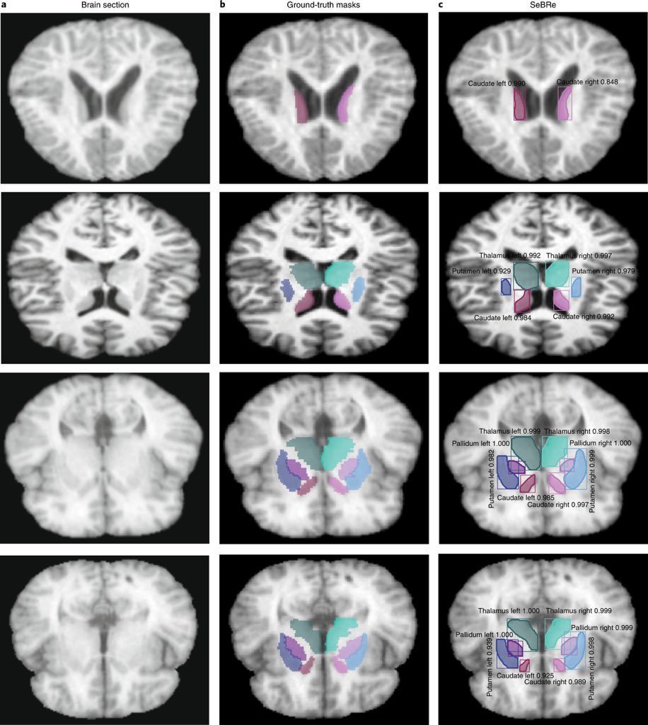 Andres_Lopez_C's tweet image. #NatureMachineIntelligence “Developing a brain atlas through deep learning (DL)” by Iqbal et al. 

📌DL can accelerate brain-wide exploration of region-specific changes in brain development and diseases.

📌Link: nature.com/articles/s4225…