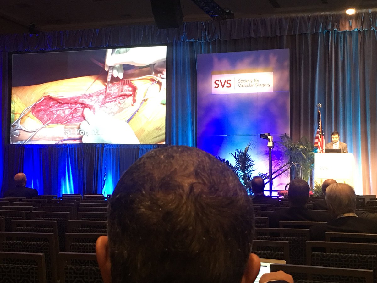 Great presentation on our direct retrograde mesenteric bypass by <a href="/SamTyagiMD/">Sam Tyagi, MD</a> !! Short conduit, infection resistant, with great patency!