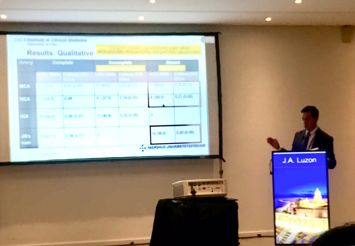 JavierLuzonMD's tweet photo. 3D anatomical models are important for surgeons. We also have to make sure they are produced correctly.
Yes to our digital twins! But identical twins! Thanks #EAES2019 @EAES_eu  @UniOslo_MED @Ahus_no #3dmodels #mesentery #digitalsurgery @me4_so #PrecisionMedicine https://t.co/AmDpltOMog