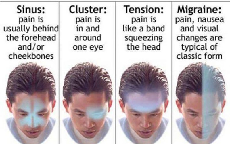scan_true_mri's tweet photo. Do you have reoccurring #headaches? Find out which type you have from the picture below.
If your headaches are affecting your daily performance, call 248-243-4MRI (248-243-4674) or visit https://t.co/yPaYZFZ57r to find out how we can help. https://t.co/HnDgeWZ9f4