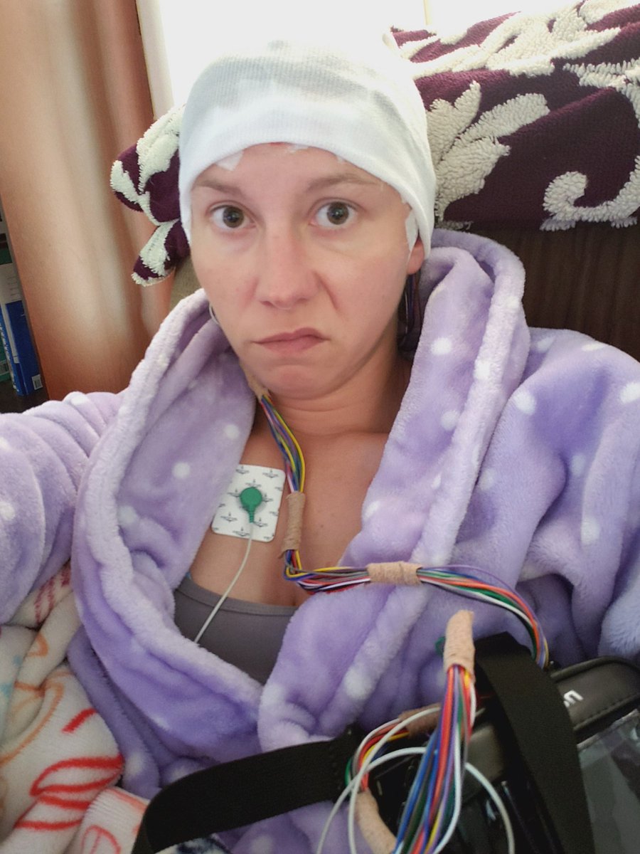 losingminddaily's tweet photo. *whining* I'm a thousand percent over this....on the plus side...only 40 more hours and I get to do it at home. Also...apparently this equipment is worth a ton...who trusts me with this shit?? ๐๐๐คฆโโ๏ธ๐คฆโโ๏ธ๐๐๐๐ญ๐ญ #mylife #shitshow #ambulatoryeeg #lookinglikeanalien https://t.co/83J3M1D4s5