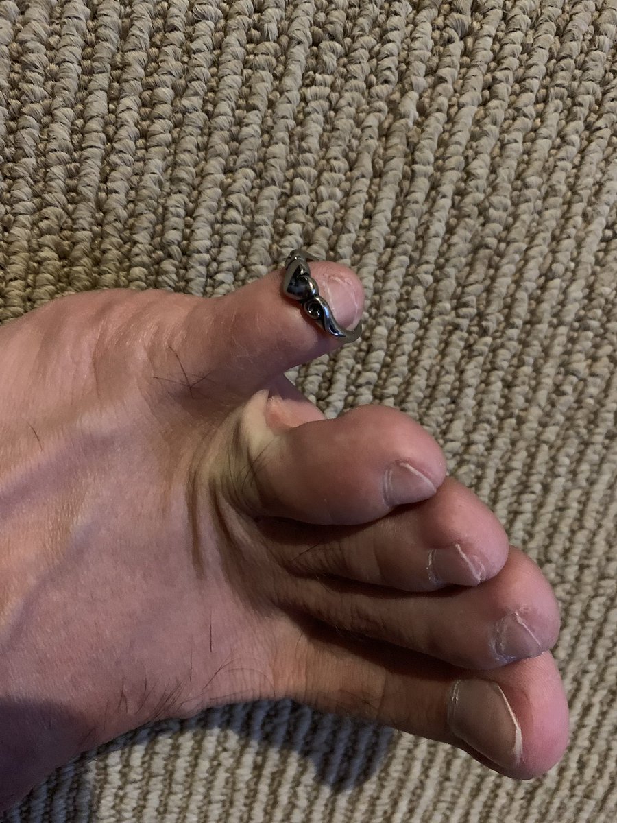 JustinIanRaymo1's tweet photo. My pinky toe just got hitched!!!
Golf clap for my pinky toe... https://t.co/uo14pXbVu5