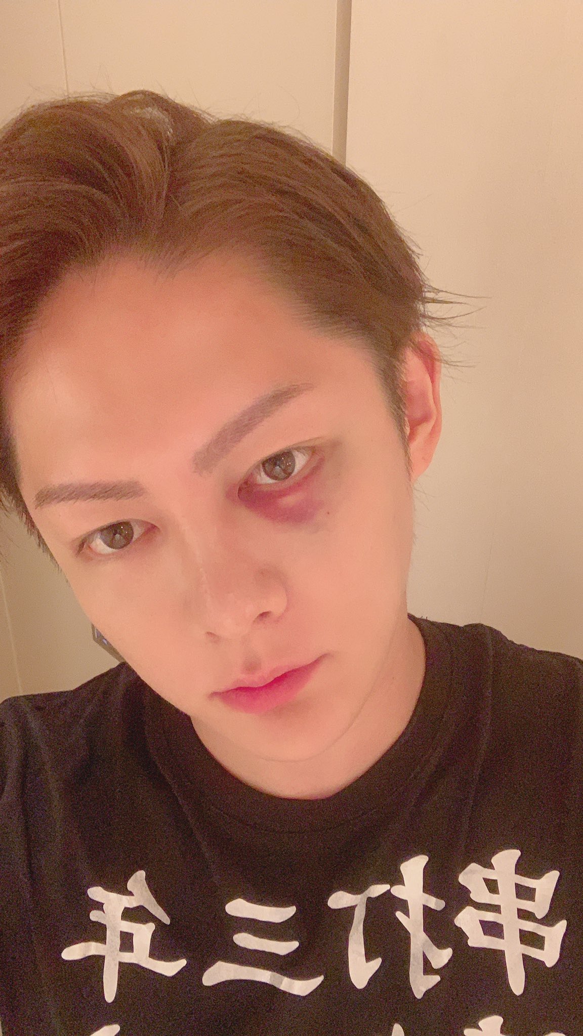 三崎優太 Yuta Misaki 青汁王子 ストレス解消にバッティングセンターいったら目に自打球した さすがに痛い 自暴自棄になってたから これで目が覚めた むしろ感謝だ へこたれるなってお告げかな T Co Tiq7quwfep Twitter