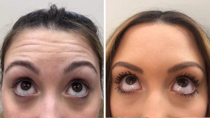 zahras's tweet photo. Doctor led medical aesthetics in Milton Keynes and London. 

Qualified, guaranteed, safe, free consultation

Lip filler wrinkle sag nose eye jaw line crows feet

Treatment available for women and men of all ages.

https://t.co/OKswABoSwO 
safia@drsthetics.co.uk
+447376445380 https://t.co/Y8bGlEQ8oV