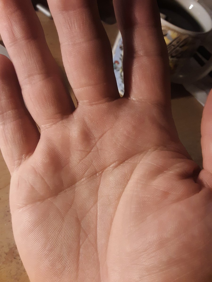 CyrekNikolas's tweet photo. Do I have a #simianline ? #palmreading https://t.co/r7ffo6bl47