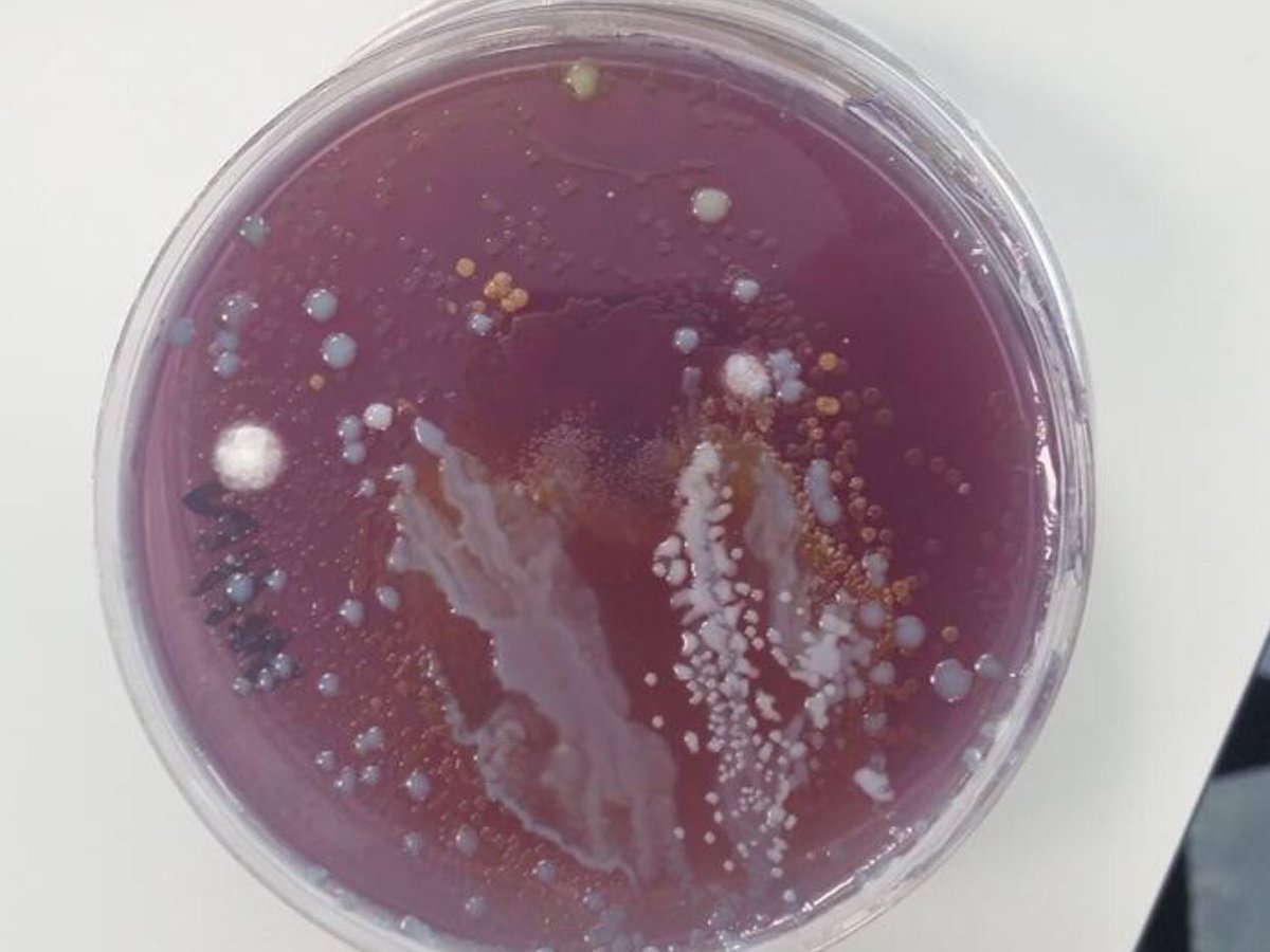 becksunique's tweet photo. Mobile phone contamination from participants @ABUHB_Research. All results will be sent tomorrow. Don’t be shy and tweet your results #cleanyourphone be a #cleanyourphonesupporter #gramnegativebacteria #infectioncontrol #HCAI #HAI #microbiology @HIS_infection https://t.co/w3ZuyLgRu6