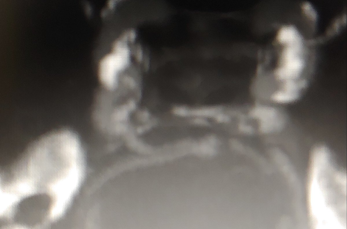 Dr. Joe Loeb 💀🧠 tweet media