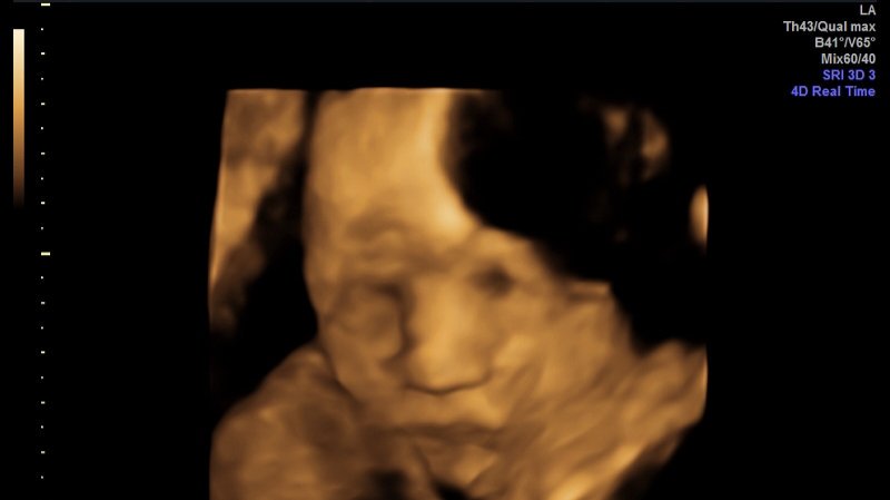 This is my 2grandson who is coming next month. At least that's what the doctors say is mid too late July I expect him sooner rather than later. I just can't wait to meet this little booger