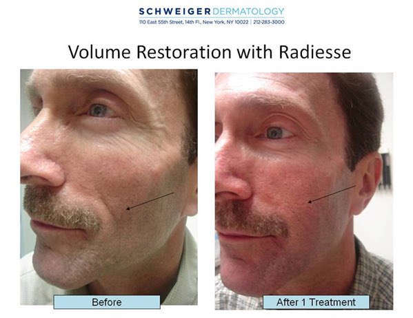 zahras's tweet photo. Doctor led medical aesthetics in Milton Keynes and London. 

Qualified, guaranteed, safe, free consultation

Lip filler wrinkle sag nose eye jaw line crows feet

Treatment available for women and men of all ages.

https://t.co/OKswABGtVo 
safia@drsthetics.co.uk
+447376445380 https://t.co/XIiBosUqUp