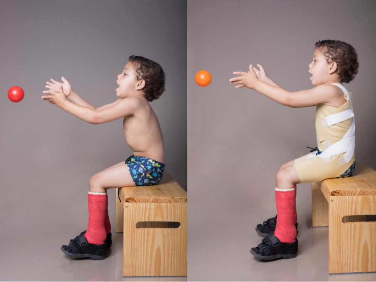 OrtopIntegral's tweet photo. Semana pasada entregamos #theratogs es una prenda ajustable que asiste a los músculos para proveer una mejoría postural, mejora el equilibrio y movimiento.
@theratogs https://t.co/BnHkV4Z4G5